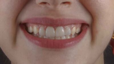 How-Fixing-Your-Smile-Can-Transform-Your-Professional-Image