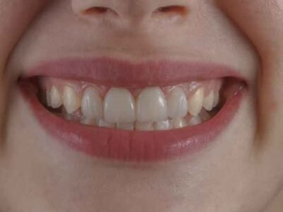 How-Fixing-Your-Smile-Can-Transform-Your-Professional-Image