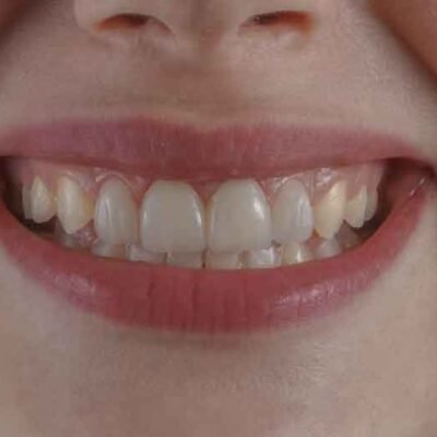 How-Fixing-Your-Smile-Can-Transform-Your-Professional-Image