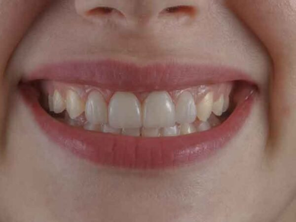 How-Fixing-Your-Smile-Can-Transform-Your-Professional-Image