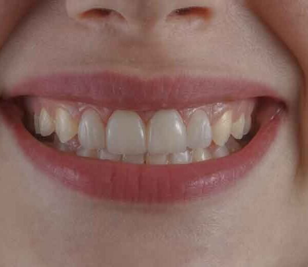 How-Fixing-Your-Smile-Can-Transform-Your-Professional-Image