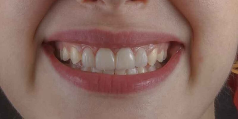 How-Fixing-Your-Smile-Can-Transform-Your-Professional-Image