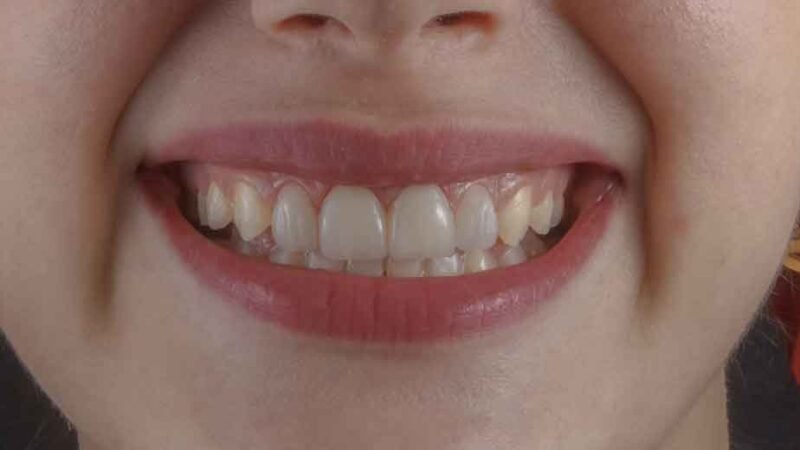 How-Fixing-Your-Smile-Can-Transform-Your-Professional-Image