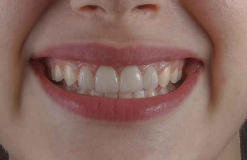 How-Fixing-Your-Smile-Can-Transform-Your-Professional-Image
