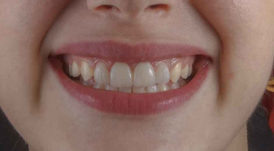 How-Fixing-Your-Smile-Can-Transform-Your-Professional-Image